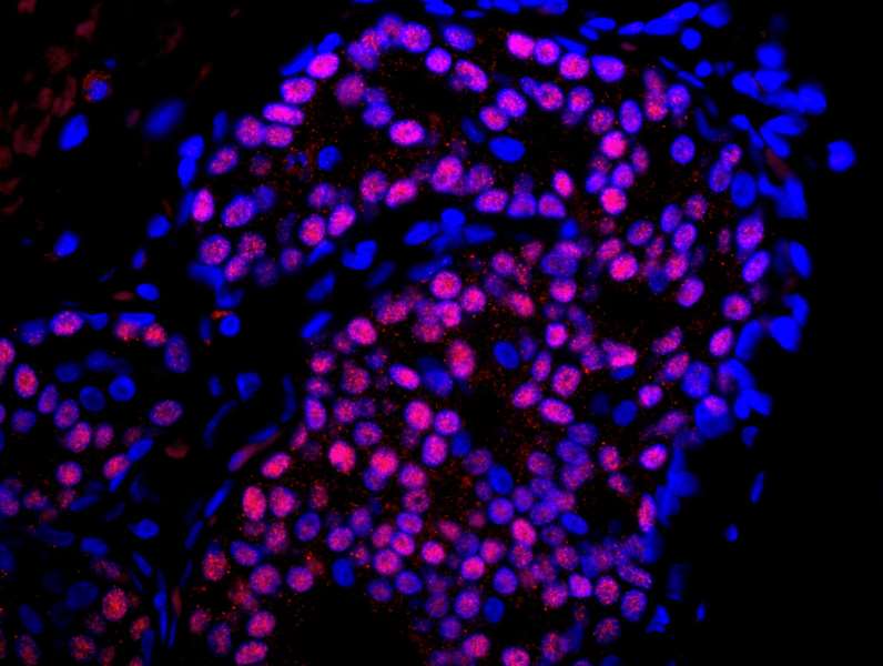 ER Alpha / Estrogen Receptor Antibody (aa550-C-term)