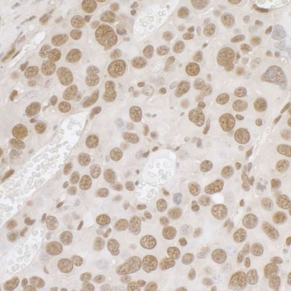 Polyclonal Rabbit anti-Human FUS / TLS Antibody (aa1-50, IHC, WB)