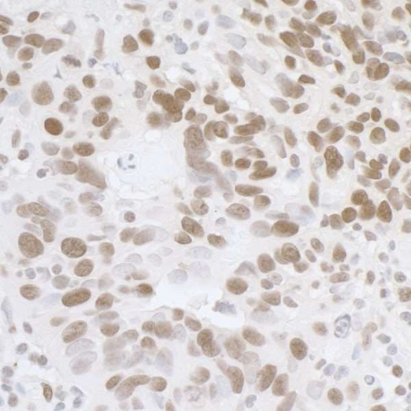 Polyclonal Rabbit anti-Human FUS / TLS Antibody (aa1-50, IHC, WB)