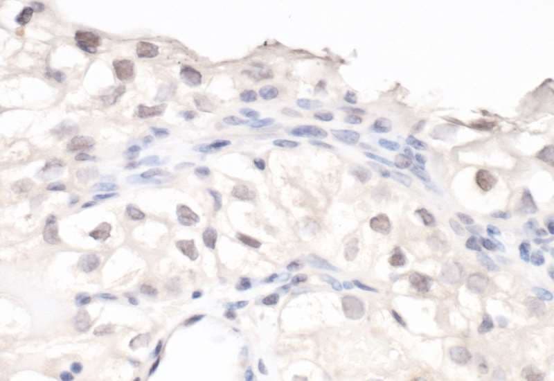 HIF1A / HIF1 Alpha Antibody (aa775-C-term)
