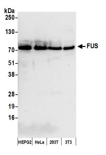 Polyclonal Rabbit anti-Human FUS / TLS Antibody (aa1-50, IHC, WB)
