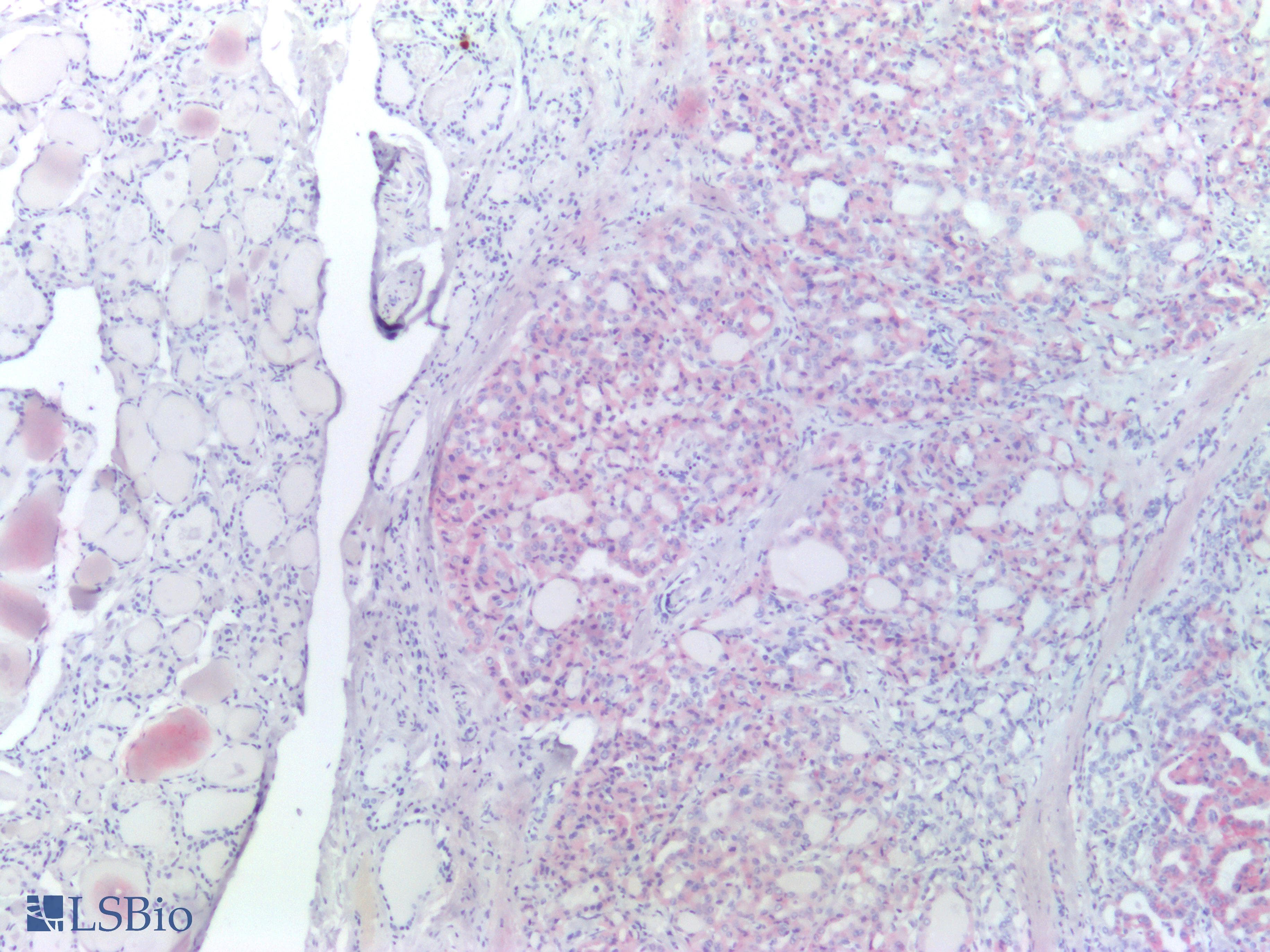 Recombinant Monoclonal Rabbit anti-Human BRAF / B-Raf Antibody (clone RM8, Ready-to-Use, Mutation V600E, IHC)
