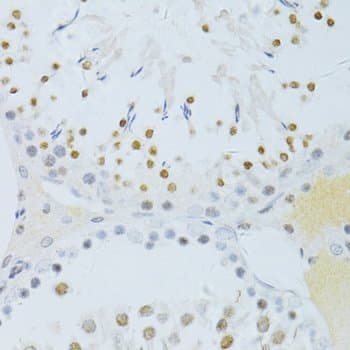 RELA / NFKB p65 Antibody (phospho-Ser276)