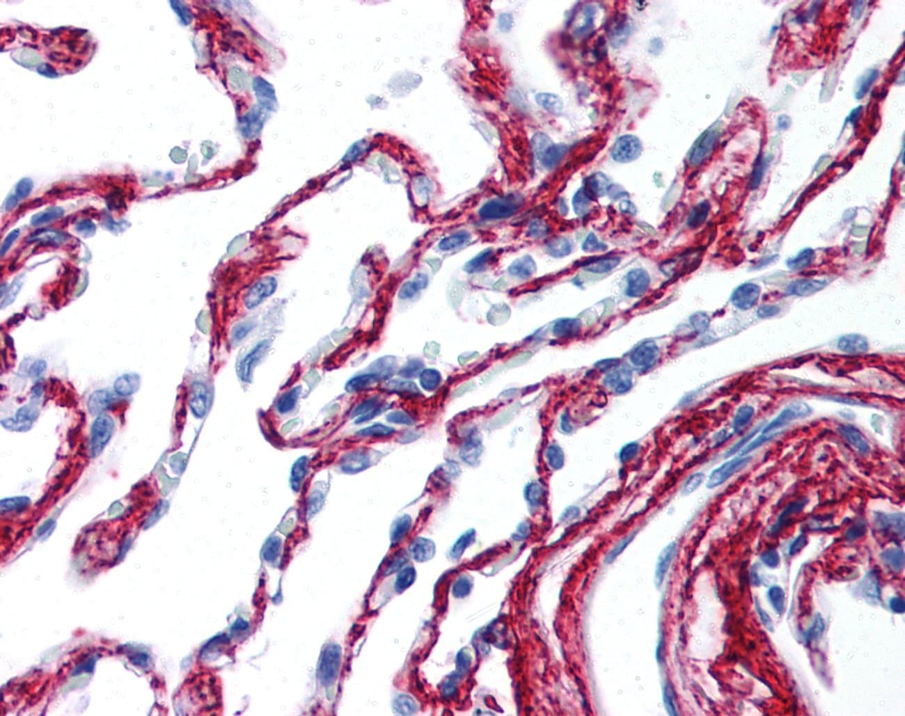 Polyclonal Rabbit anti-Human COL6A1 / Collagen VI Alpha 1 Antibody (IHC)