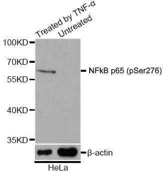 RELA / NFKB p65 Antibody (phospho-Ser276)