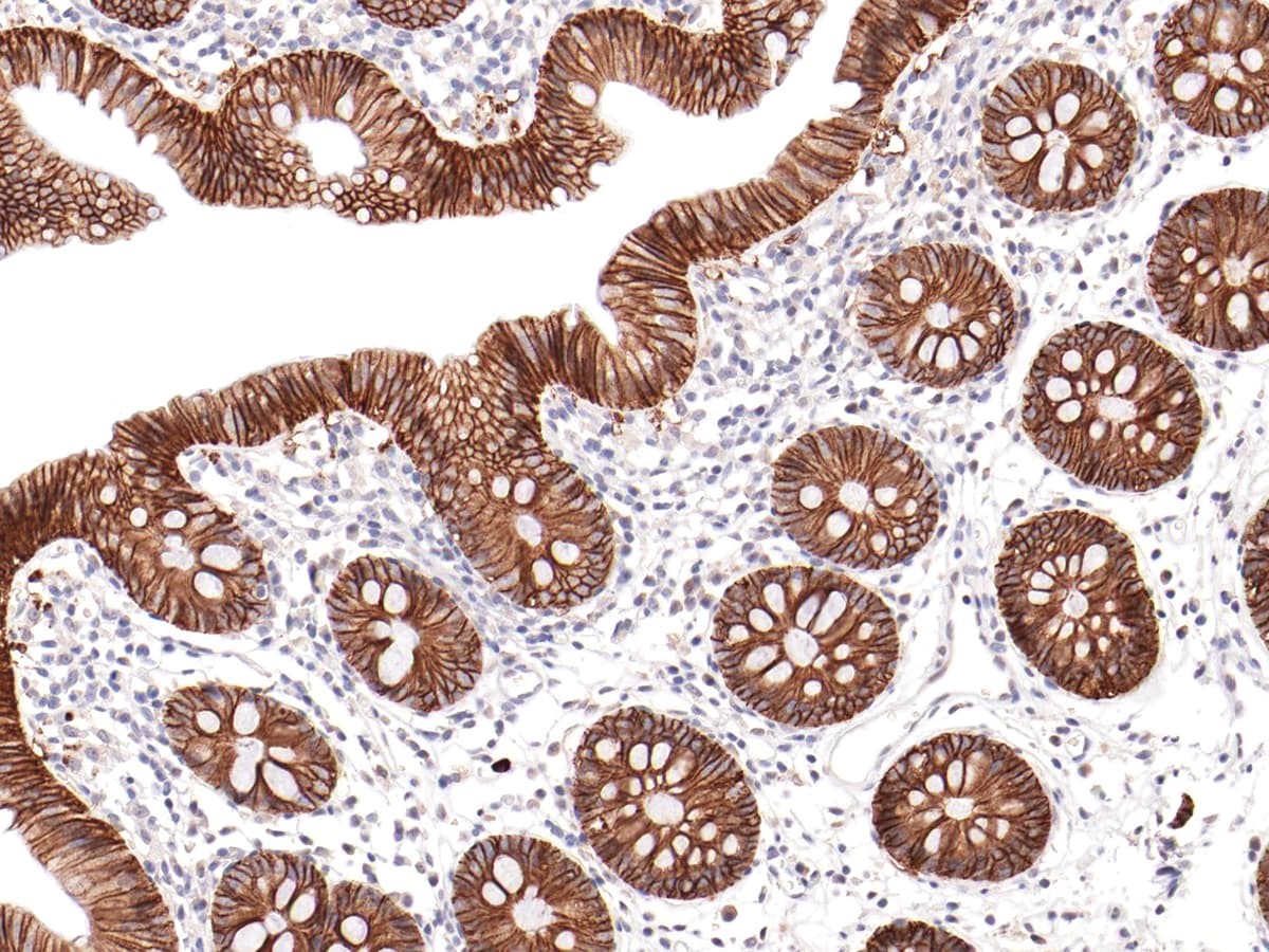 EPCAM Antibody (Ready-to-Use)