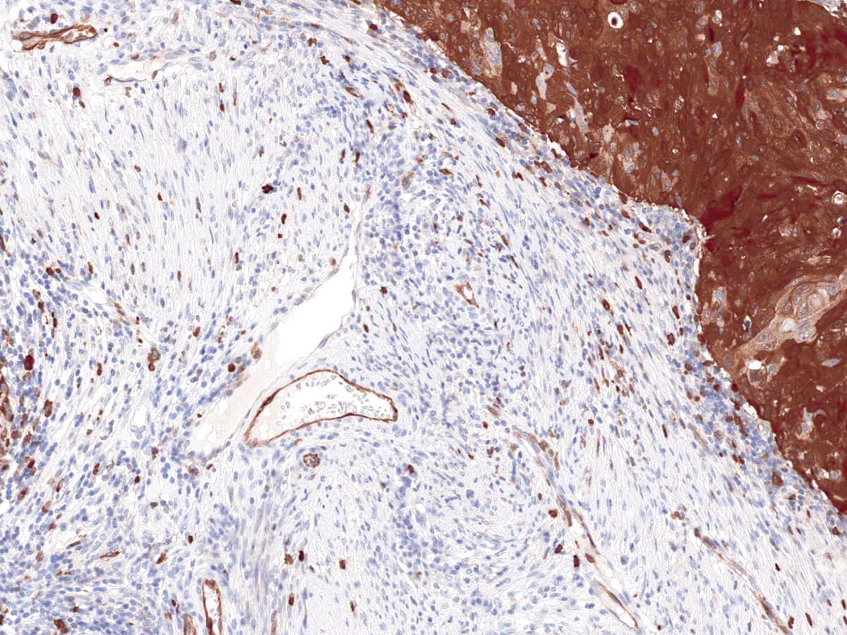STMN1 / Stathmin / LAG Antibody (Ready-to-Use)