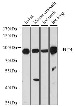 Polyclonal Rabbit anti-Human FUT4 / CD15 Antibody (IHC, WB)