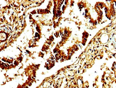 ADAMTS4 Antibody