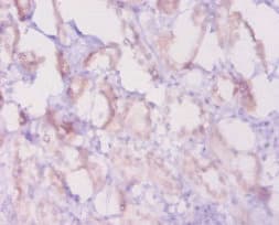Polyclonal Rabbit anti-Mouse BCL2 / Bcl-2 Antibody (IHC, WB)