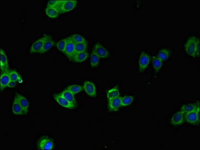 Polyclonal Rabbit anti-Human BRAF / B-Raf Antibody (IHC, IF)