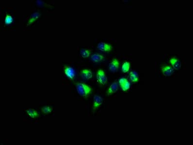 Polyclonal Rabbit anti-Human CA4 / Carbonic Anhydrase IV Antibody (IHC)