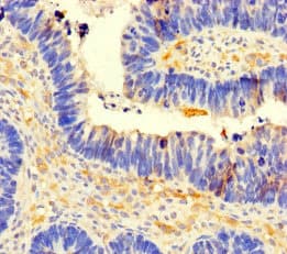 CCDC66 Antibody