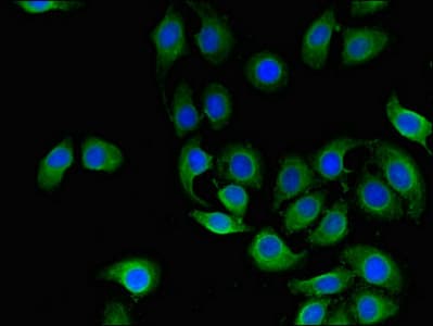Polyclonal Rabbit anti-Human CD151 Antibody (IF, WB)