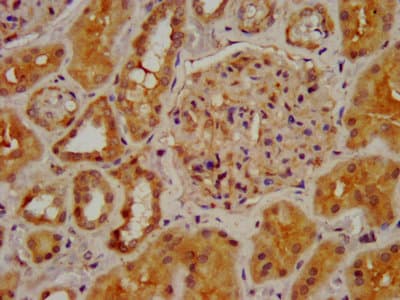 Polyclonal Rabbit anti-Human CHRNB2 Antibody (IF, WB)