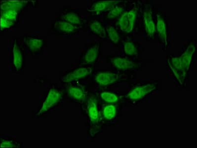Polyclonal Rabbit anti-Human CRKL Antibody (IF, WB)
