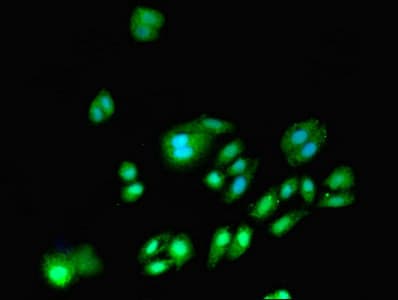 Polyclonal Rabbit anti-Human DNMT3A Antibody (WB)