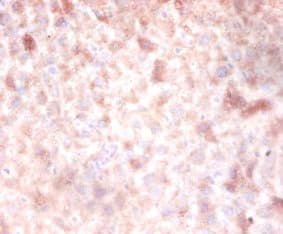 Polyclonal Rabbit anti-Human DNMT3A Antibody (WB)