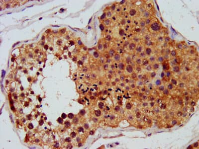 FGFR3 Antibody