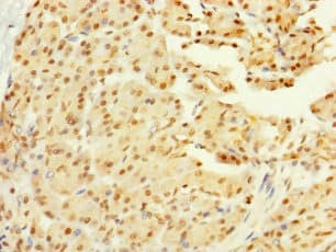 GALK2 Antibody