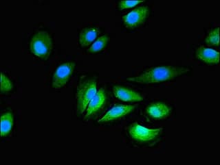 Polyclonal Rabbit anti-Human GRIN2C / NMDAR2C / NR2C Antibody (IHC, IF)