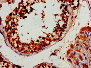 HEXIM2 Antibody