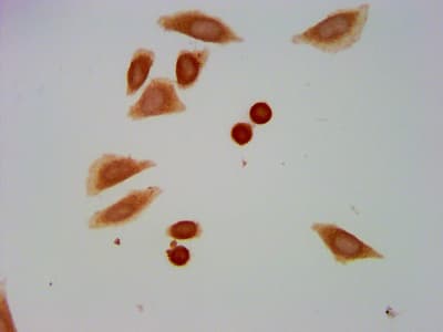 Polyclonal Rabbit anti-Human HIST1H1C Antibody (IF, WB)