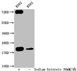 Polyclonal Rabbit anti-Human HIST1H1C Antibody (IF, WB)
