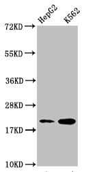 Polyclonal Rabbit anti-Human HIST1H1C Antibody (IHC, IF, WB)