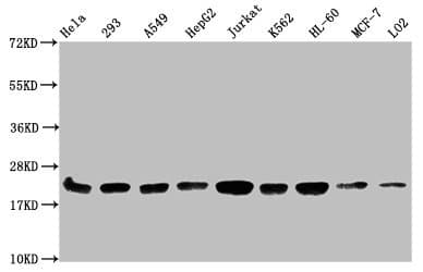 Polyclonal Rabbit anti-Human HIST1H1C Antibody (WB)