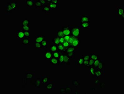 Polyclonal Rabbit anti-Human HIST1H1E Antibody (IHC)