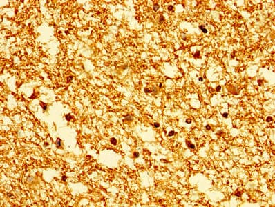 Polyclonal Rabbit anti-Human HIST1H1E Antibody (IHC)