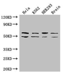 Polyclonal Rabbit anti-Human IMP-3 / IGF2BP3 Antibody (IHC, IF, WB)
