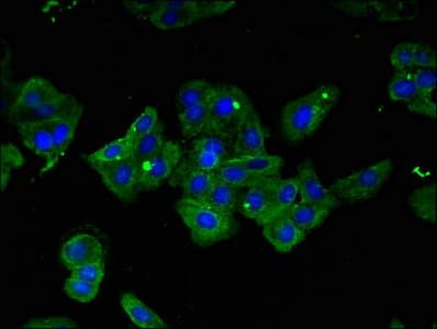 Polyclonal Rabbit anti-Human IRF6 Antibody (IF, WB)