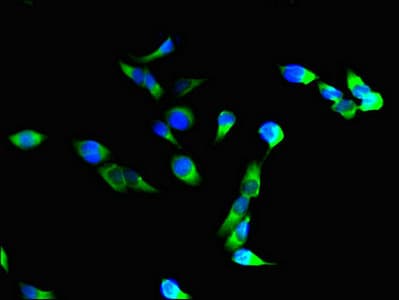 Polyclonal Rabbit anti-Human ITGAM / CD11b Antibody (IHC, IF)
