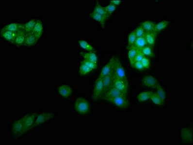 KCNAB1 Antibody