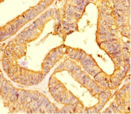 LIMS3 Antibody