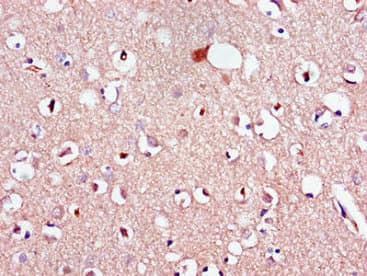 Polyclonal Rabbit anti-Human LPAR1 / LPA1 / EDG2 Antibody (IHC, IF)