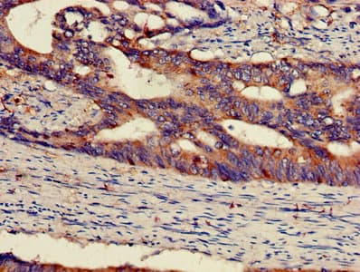 Polyclonal Rabbit anti-Human MAP2K1 / MKK1 / MEK1 Antibody (IHC, WB)