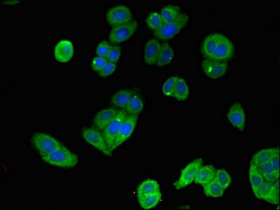 Polyclonal Rabbit anti-Human MAP2K4 / MKK4 Antibody (IF, WB)