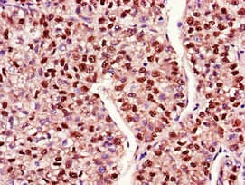 Polyclonal Rabbit anti-Human MAP2K4 / MKK4 Antibody (IF, WB)