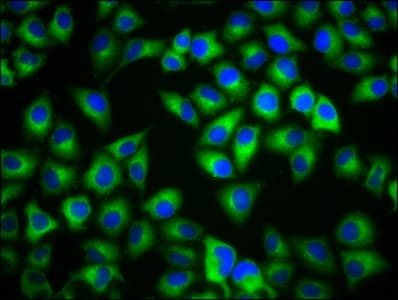 Polyclonal Rabbit anti-Human MC1R Antibody (IHC, WB)