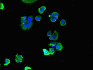 Polyclonal Rabbit anti-Human MLC2 / MYL9 Antibody (IHC, IF)