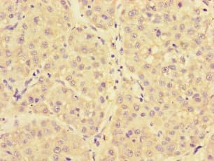 NARS Antibody