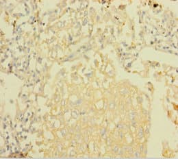 NDUFA6 Antibody