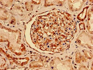 Polyclonal Rabbit anti-Human NES / Nestin Antibody (IF)