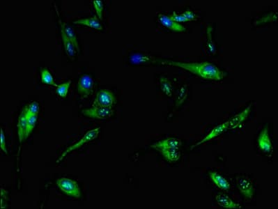 Polyclonal Rabbit anti-Human PFKL Antibody (IHC, IF, WB)