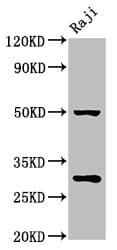 Polyclonal Rabbit anti-Human PHB / Prohibitin Antibody (IHC, WB)