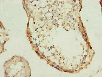 PHF10 Antibody