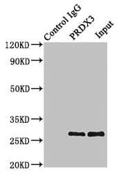 Polyclonal Rabbit anti-Human PRDX3 / Peroxiredoxin 3 Antibody (IHC, IF, WB)
